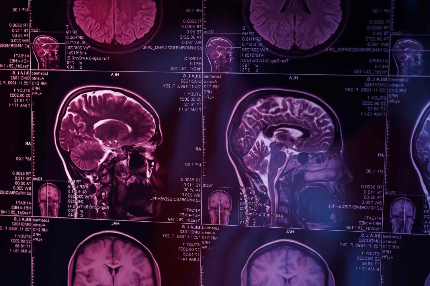 en mexico alrededor del 15 millones de personas pdecen alzheimer